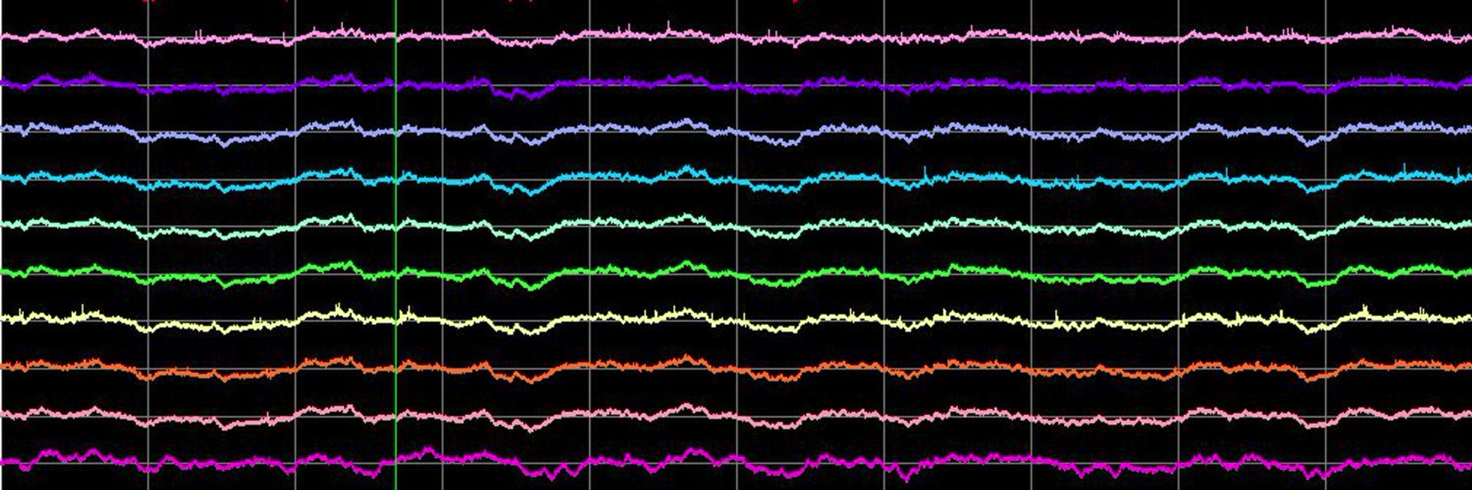 Cognitive Neurophysiology