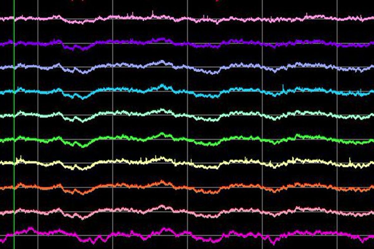 Cognitive Neurophysiology