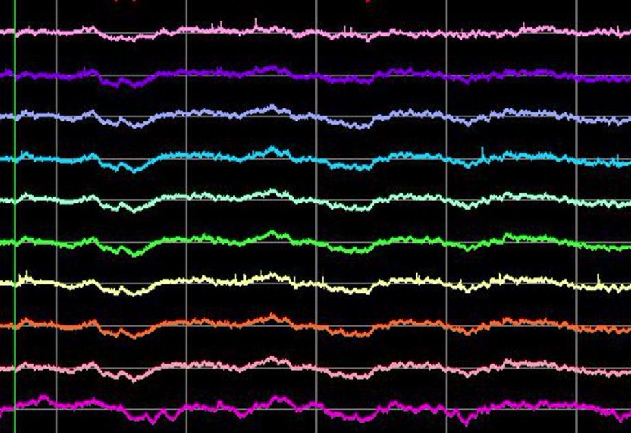 Cognitive Neurophysiology
